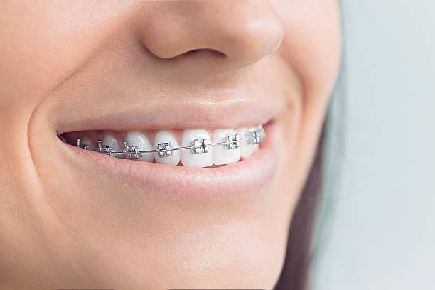 Why Choose Us for Your Dental Needs in Mount Morris, MI